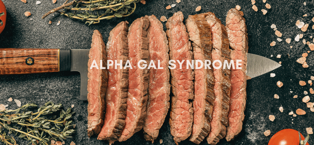 Understanding Alpha Gal Syndrome: Natural Approaches for Management and Healing