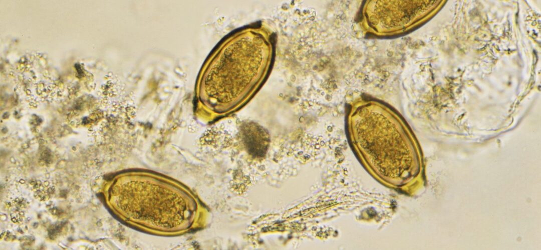 Whipping Away Whipworms: How a Tiny Parasite Can Disrupt Your Gut, Energy, and Mood